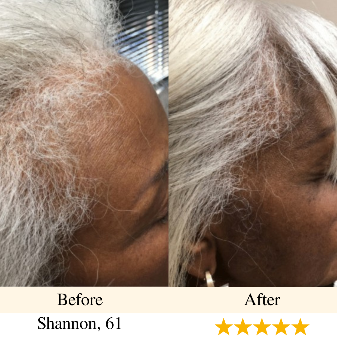 girlova. Scalp Roller