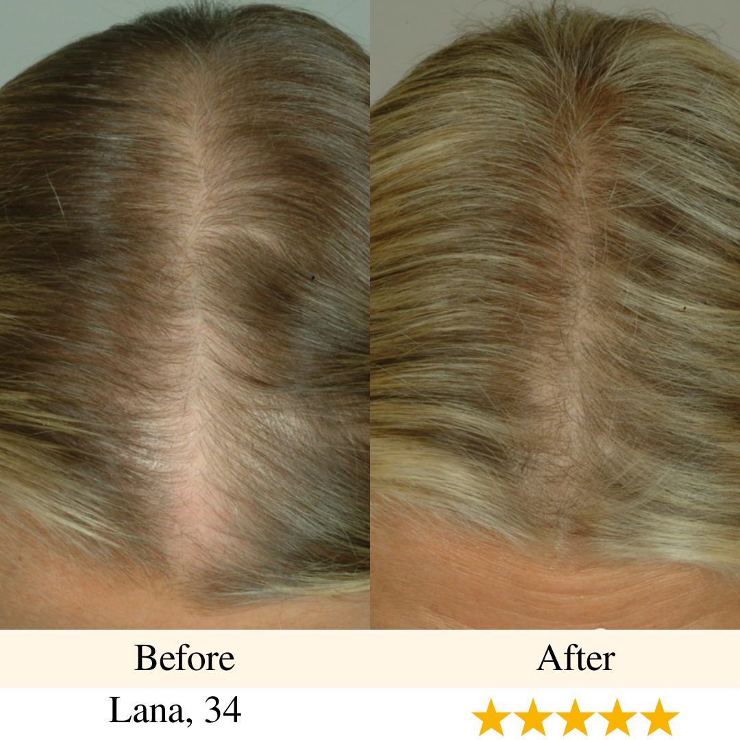 girlova. Scalp Roller