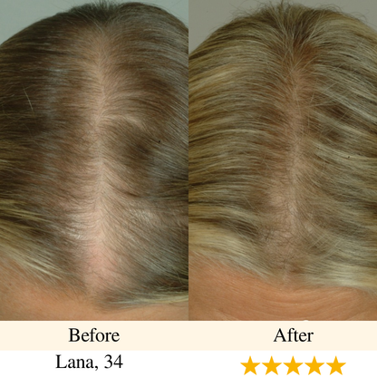 girlova. Scalp Roller