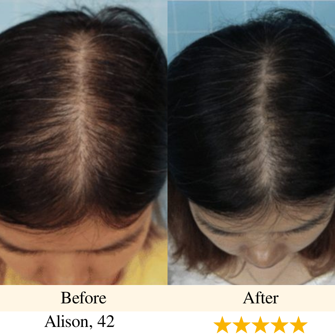 girlova. Scalp Roller