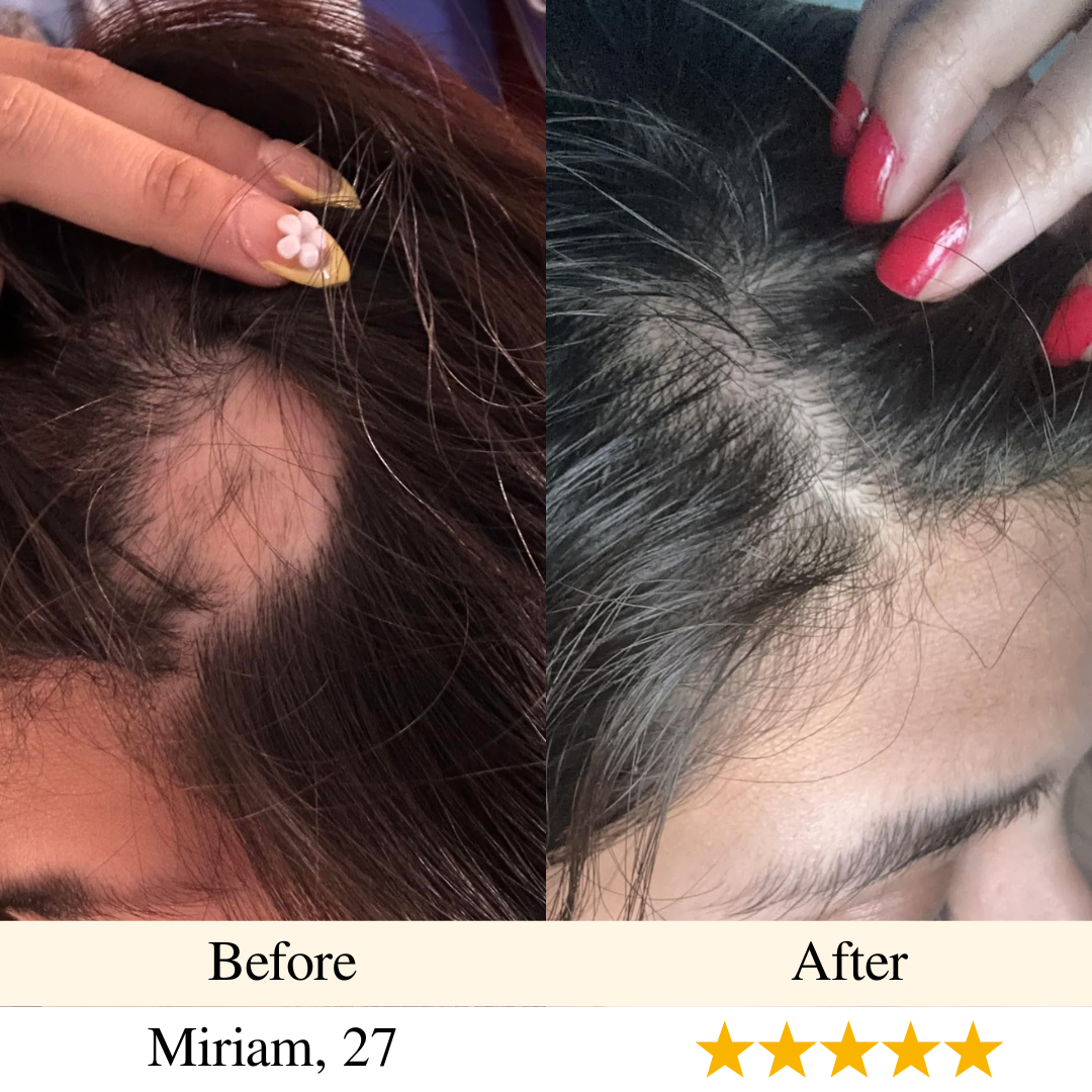 girlova. Scalp Roller